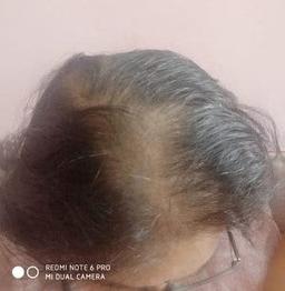 customer stage 1
