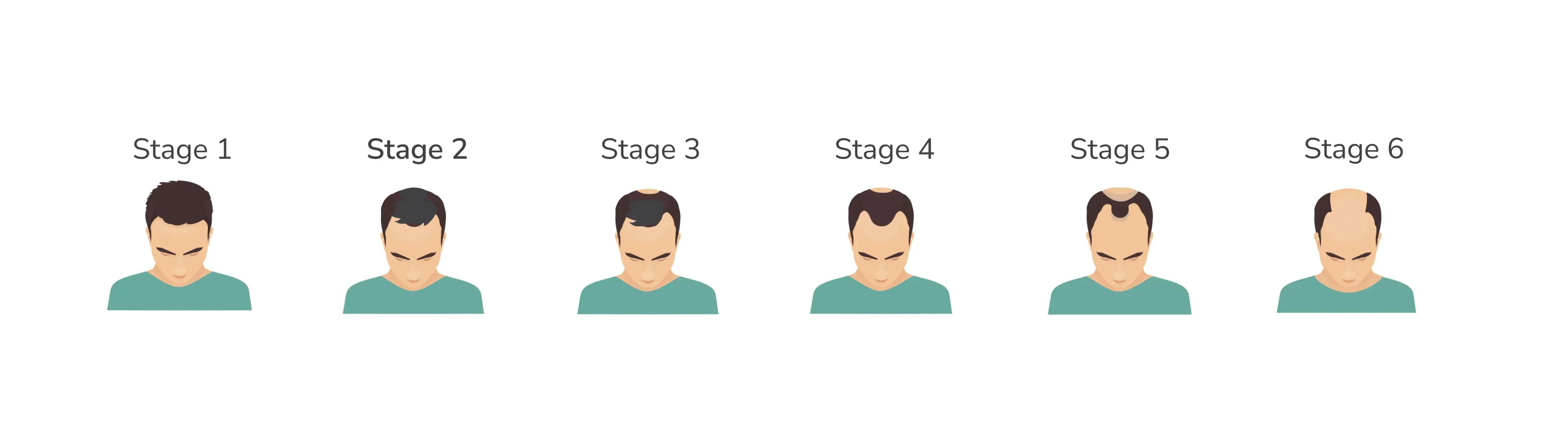 male stages